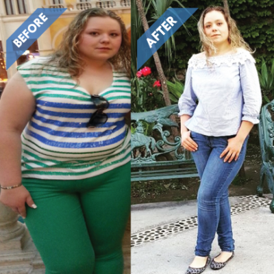 jacqueline-before-and-after jacqueline-before-and-after